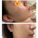 리즈라인 | 부산 남구 피부관리 리즈더라인 방문후기 환절기피부관리 재생앰플 용호동피부관리추천 용호동에스테틱...