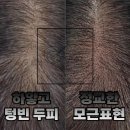 모란홍천