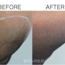 일러스라인 이미지