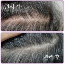 두피열 내리고 리프팅까지!? 얼굴라인 싹 올라가는 Dr.SYS 닥터시스 리셋 스칼프 헤어세럼 후기