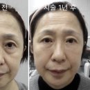 아름다운미탐의원 네이버블로그