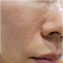 밴스의원 | 밴스의원 명동 을지로에서 리쥬란 받아본 후기!