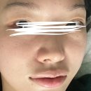 석촌역 2번출구 앞 | 송파 조이스킨앤스파 / 석촌역 성형 수기 안면윤곽 전문 에스테틱에서 시그니처관리 후기