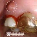 서울에스(S)퍼스트치과의원 이미지