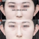 하이코코 이미지