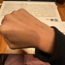 브라운트리지나 | 간 이식 수술 공여자 후기 일곱번째 - 퇴원 후 4개월부터 6개월