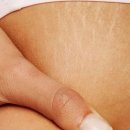 항가령피부연구소