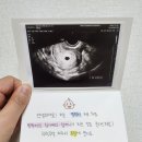 [포항/임신] 임신 초기 1주~6주차 기록 (Feat.미래여성병원, 여성아이병원)