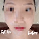 훼미리프라자빌딩 앞 | 얼굴 탄력 잡아주는 평촌피부관리 이경연뷰티테라피 윤곽관리 후기