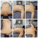 평택 비전동 통증 체형관리 전류테라피 1회 받고 신세계 경험중 (한결메디테틱)