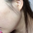 엘뷰티 남포점 | 남포동 여드름압출 웨딩관리 승모근 비포에프터 사진첨부, 가격정보, 내돈내산