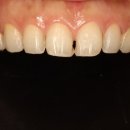 용치과기공소 이미지