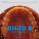 조성주치과의원 네이버블로그