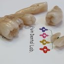 수인치과기공소 이미지