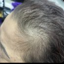 머리사랑 | 창동 미용실 단골 많은 이유 있었어요, 엄마 머리 성공한 큐사랑 삼익쇼핑점 후기