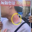 전치 앞(2) 이미지