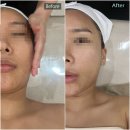 마스크오브미라클 | 광주 진월동&lt;리숨에스테틱&gt;보이저진월 내돈내산 / 피부관리샵 추천
