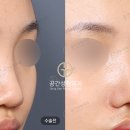케이스코 이미지