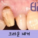 연세바른치과 이미지