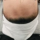 라비에벨헤어 이미지
