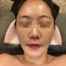 광진구피부관리 re본에스테틱 스페셜 맞춤관리 후기