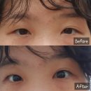 상인신일해피트리경로당 | [ 대구 상인동] 대구 달서구 상인동 속눈썹펌 잘하는 곳 &#39;제브로우&#39;에서 속눈썹펌 후기