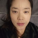 &#34;울트라 클리어&#34;레이저 솔직후기 ㅣ피부개선 종합선물세트! 효과와 장단점