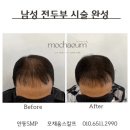 모채움스칼프