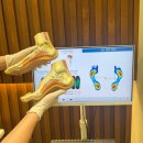 코오롱글로벌(주) 대구센터 | 대구 체형교정&amp;통증케어 추천 | 러닝 후 통증으로 <HS운동센터> 방문한 후기