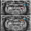 서울유플란트치과의원 이미지