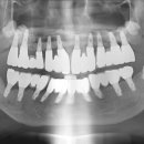 수플란트치과의원 이미지