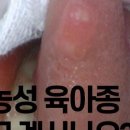 운정세브란스치과의원 네이버블로그