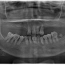엘치과병원 이미지
