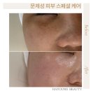 하영피부관리 이미지