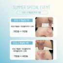 부천피부관리 써니뷰티 물방울리프팅 후기_40대는 리프팅이지!
