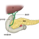 바터 팽대부 암(AOV cancer) 이미지