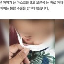 [단독] 3살 아들 얼굴에 박힌 다트핀..쇼핑몰서 날벼락 이미지