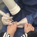 호평첨단주유소 | 【 슈블리왁싱&amp;푸스인솔 남양주평내점 】 평내호평문제성발톱 관리 전후 차이! 이제 당당하게 샌들...