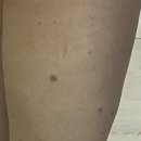 이화사랑피부과의원 이미지