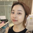비니드헤어 이미지