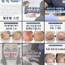 필온필스킨