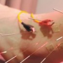 스타한의원 이미지