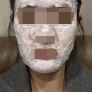 유노성형외과의원 네이버블로그