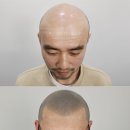 리게인프로젝트 강남본점 이미지