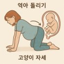 [임신 후기] 31주 차 역아 돌리기 성공