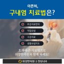 볼안쪽 구내염, 구내염 치료는 위강한의원 강동점 이미지