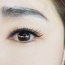 서울피부비만센터 스킨앤슬림 네이버블로그