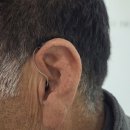 B9 | 세종시보청기 장애 지원으로 유니트론 Moxi B9-R 착용한 고객 후기