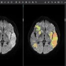 제이엘케이 이미지