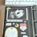 마디사랑의원 | [임신일기#7] 13-15주차ㅣ니프티 결과ㅣ신경관 결손, 취약x증후군 검사ㅣ청주 엠에스여성의원